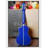 LUNA UKE DPN